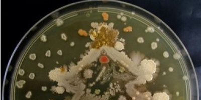 Агар арт – микробиолози създават Ван Гог и други шедьоври с палитра от бактерии.