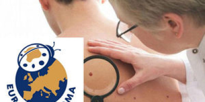 Безплатни профилактични прегледи за меланом и рак на кожата