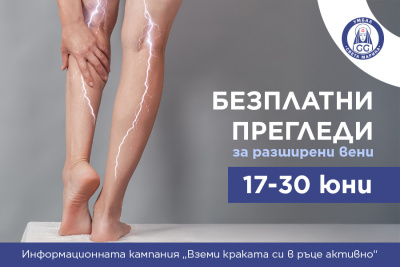 Водещи лекари от УМБАЛ „Света Марина“ – Плевен ще преглеждат безплатно за разширени вени през юни