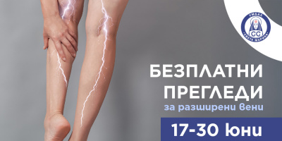 Водещи лекари от УМБАЛ „Света Марина“ – Плевен ще преглеждат безплатно за разширени вени през юни