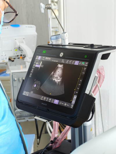 Въвеждат нов стандарт в лечението на тежка пневмония в УМБАЛ „Света Марина“ – Плевен